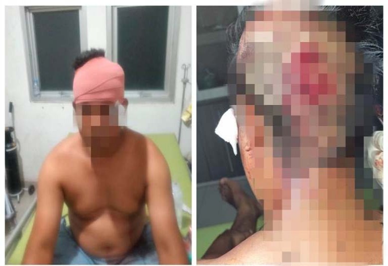 Polisi Berhasil Ringkus Pelaku Penganiayaan di Muara Kaman