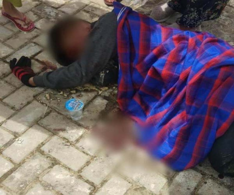 Pegawai Koperasi yang jadi Korban Pembacokan Meninggal Dunia