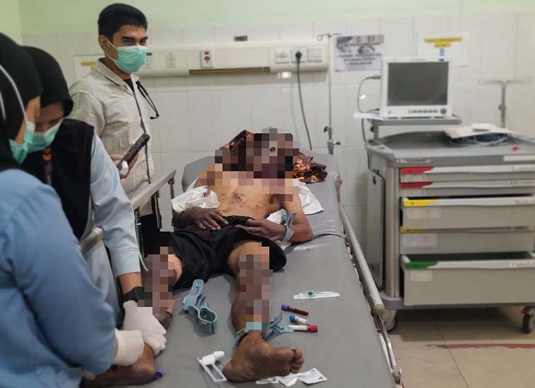 Pria di Loa Duri Ilir Alami Luka Bakar, Diduga Menjadi Korban Serangan Orang Tak Dikenal